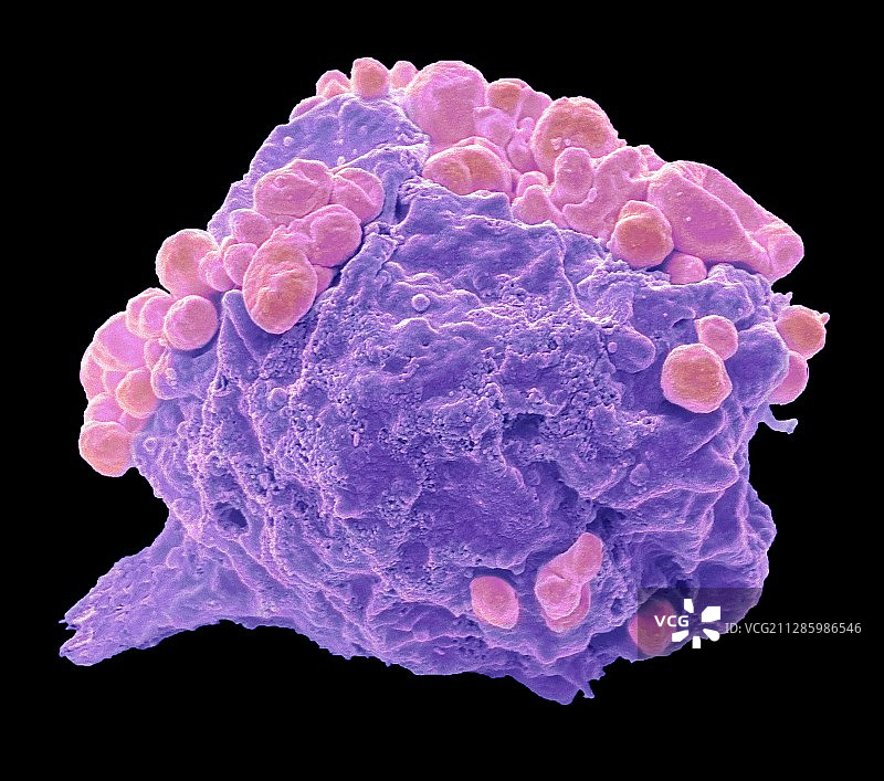 淋巴瘤细胞，扫描电镜图片素材