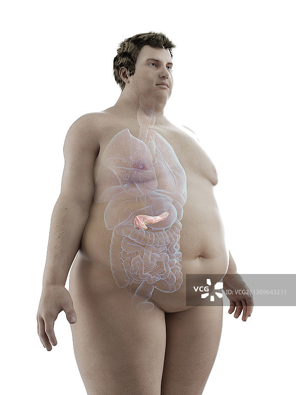 图示:一个肥胖男子的胰腺图片素材