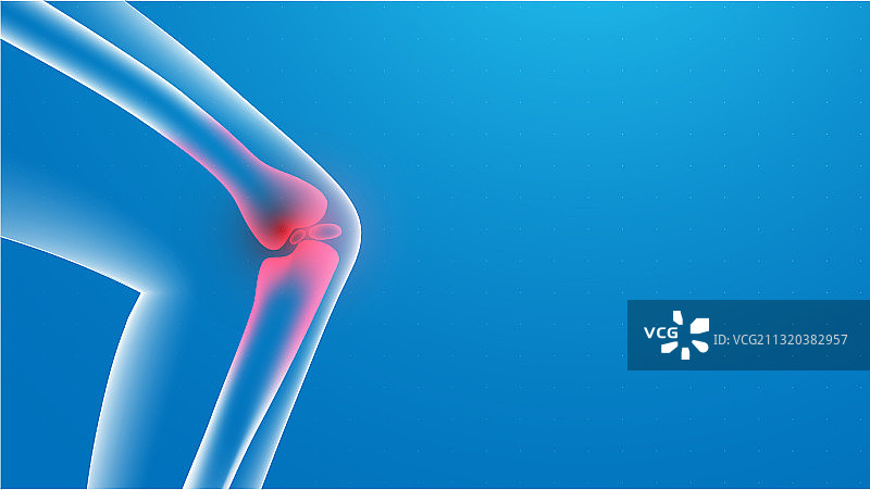 3d膝关节疼痛x光关节疼痛图片素材