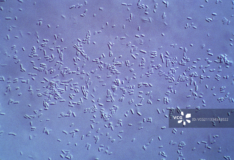 腐臭水样本中的细菌图片素材