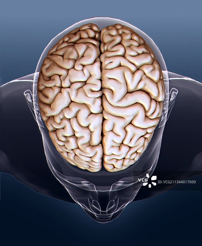 人类大脑，核磁共振扫描图片素材