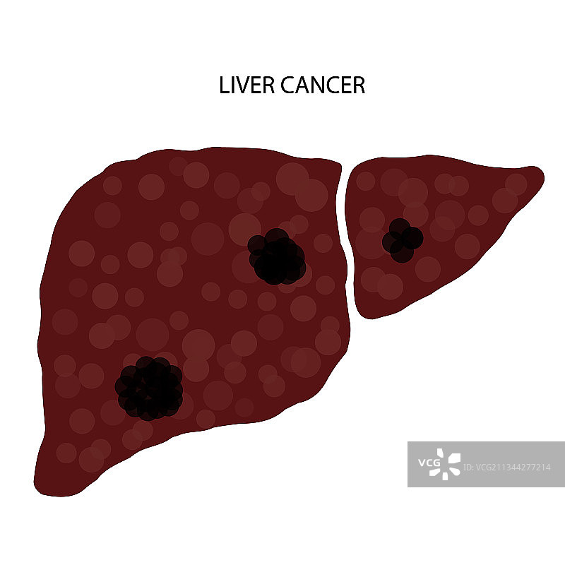 肝脏疾病的概念图片素材