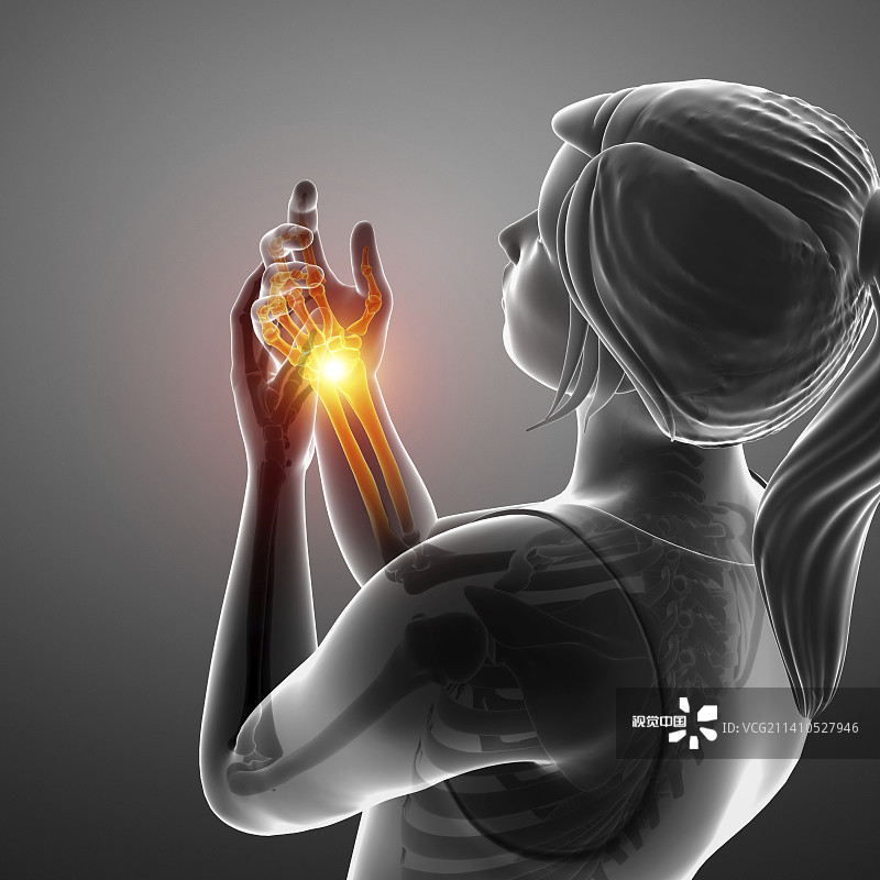手腕疼痛的妇女，插图图片素材