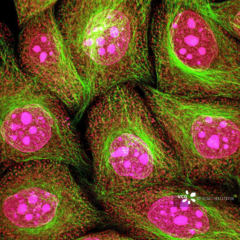 海拉细胞，光镜照片图片素材
