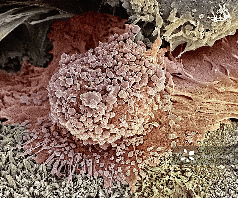骨癌细胞，扫描电镜图片素材