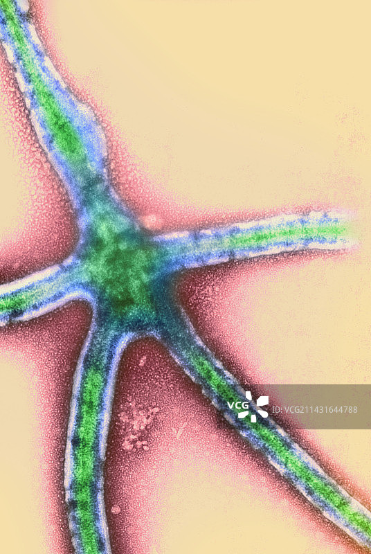 埃博拉病毒复制，透射电镜图片素材