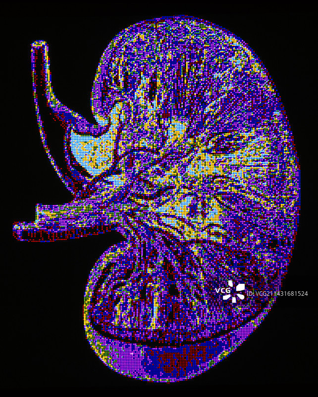 正常人体肾脏的计算机图形图像图片素材