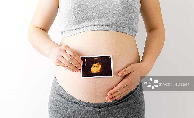 一位年轻孕妇手拿着一张胎儿B超照图片素材