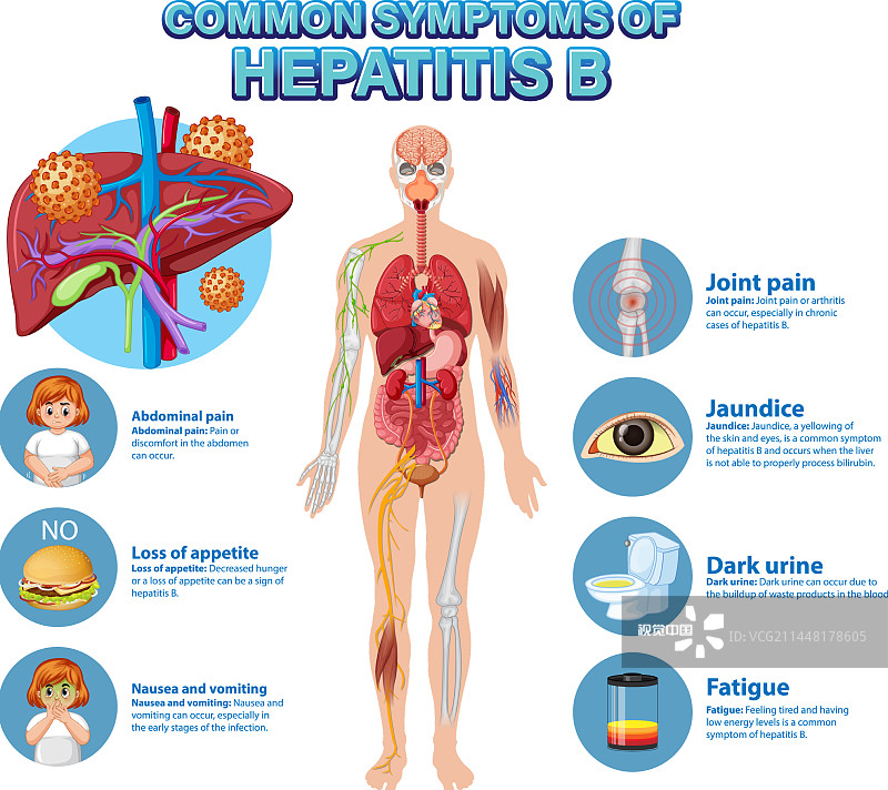 乙型肝炎常见症状的信息海报图片素材