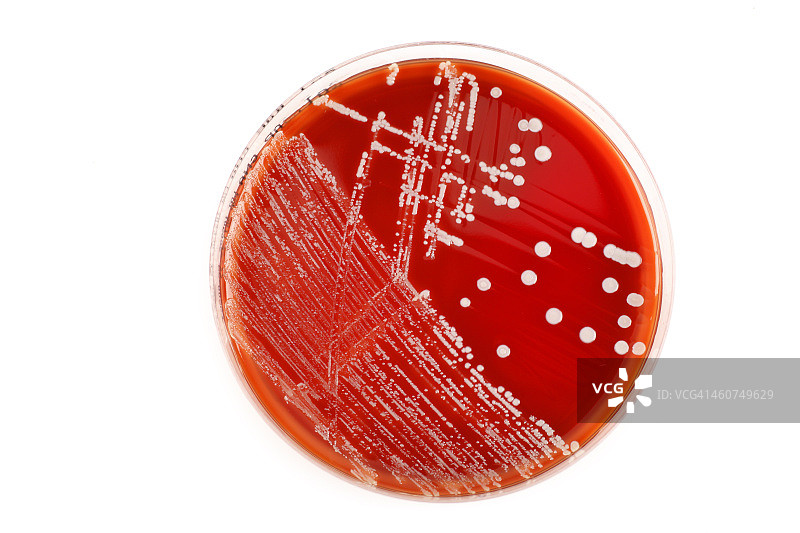 白色背景上有细菌的红色培养皿图片素材
