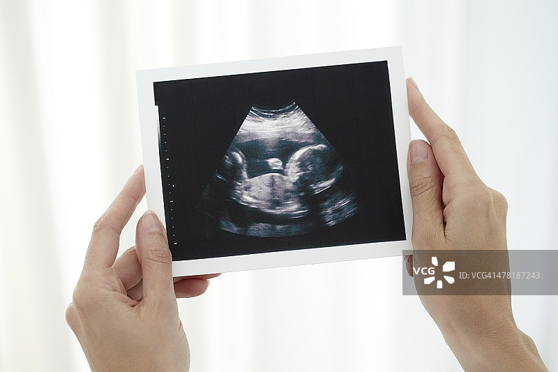 婴儿扫描图片素材