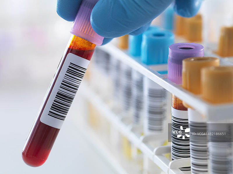 血液样本与一排人体样本一起在实验室进行分析测试，包括血液、尿液、化学物质、蛋白质、抗凝血剂和艾滋病毒图片素材