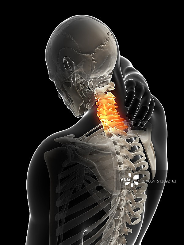 人类颈部疼痛，艺术品图片素材