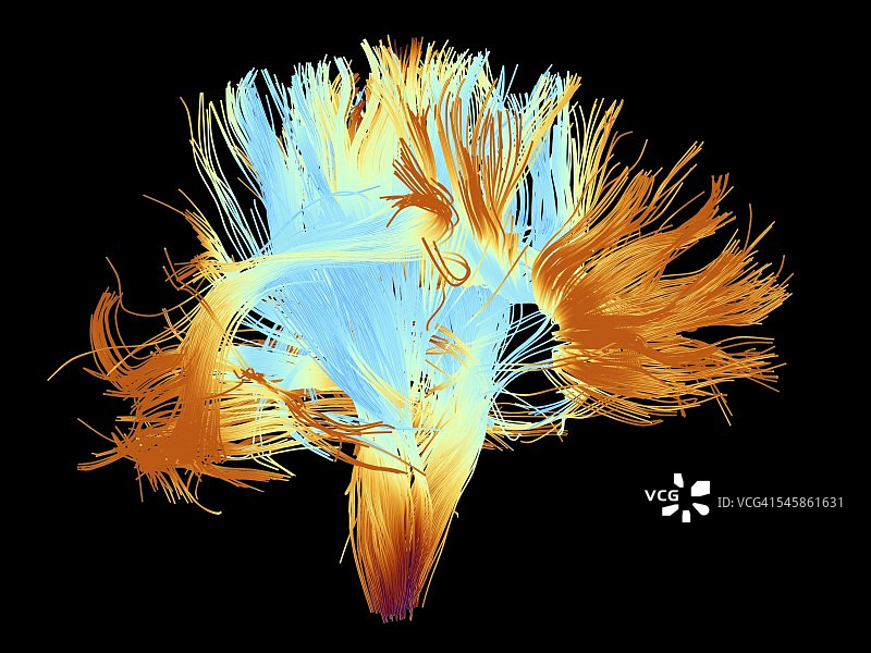 人类大脑的白质纤维图片素材