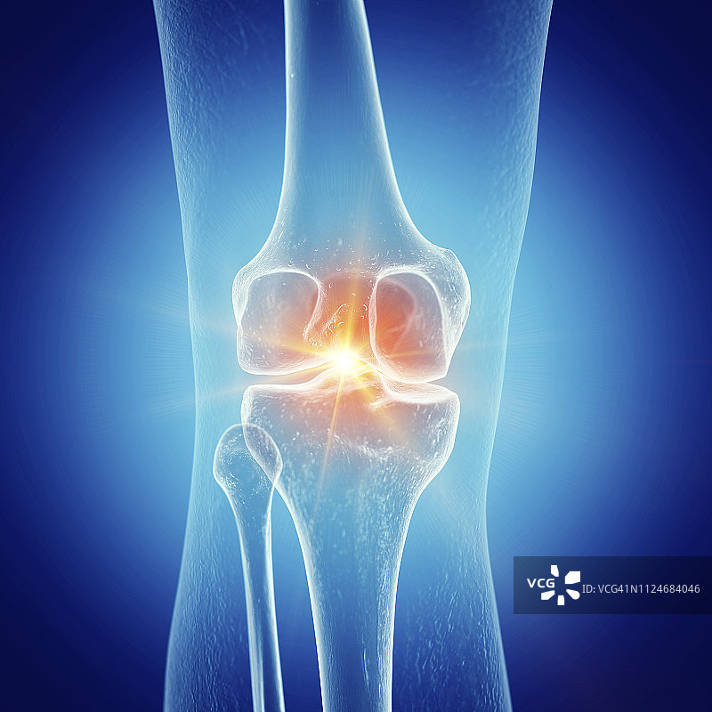 膝关节疼痛的说明图片素材