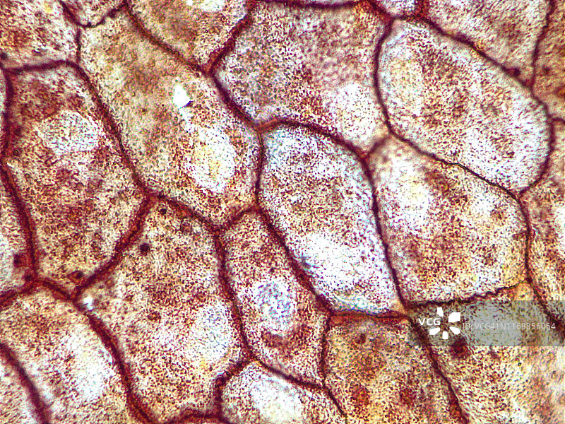 单纯性鳞状上皮，100x光显微镜下图片素材