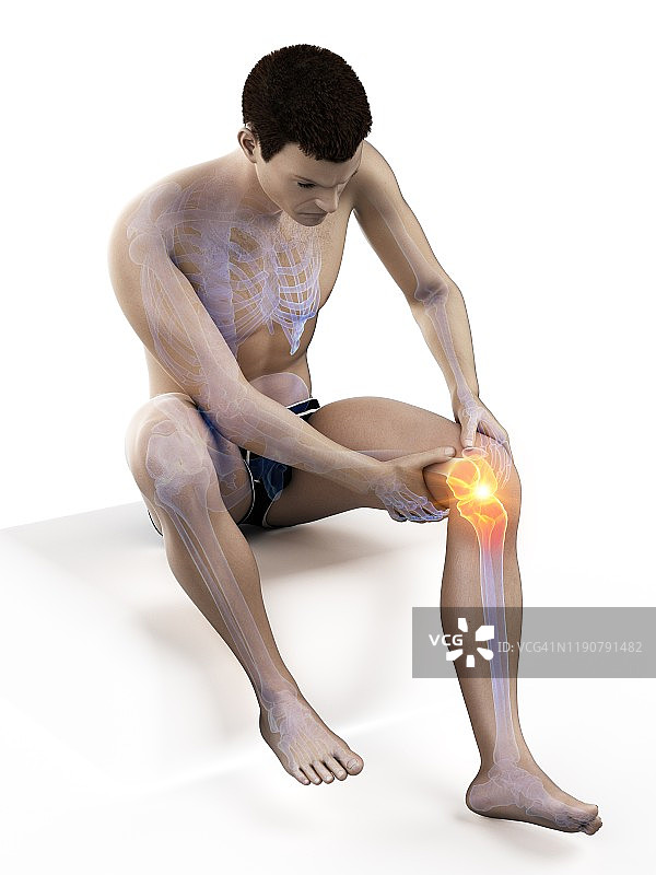 膝盖疼痛，概念说明图片素材