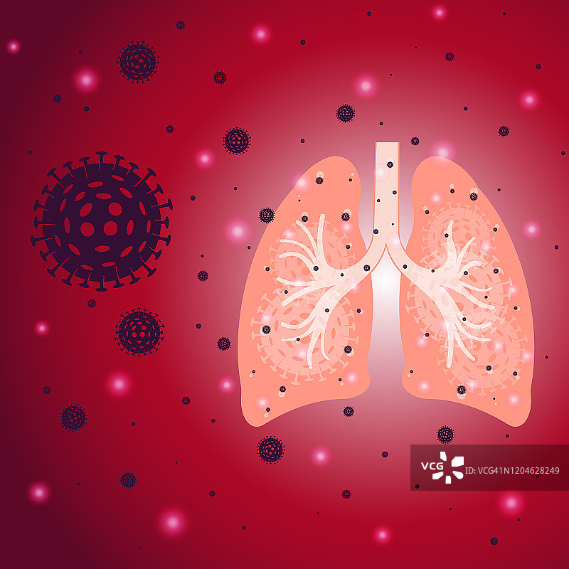 肺部冠状病毒感染图片素材