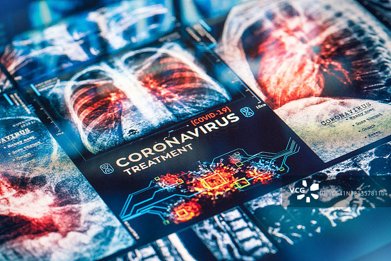 COVID-19冠状病毒治疗图片素材