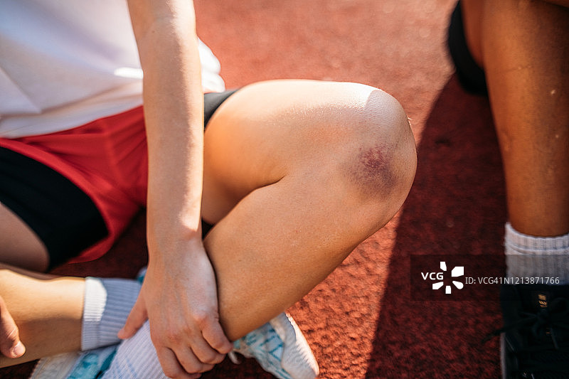 一位女运动员坐在体育场上擦伤的膝盖图片素材