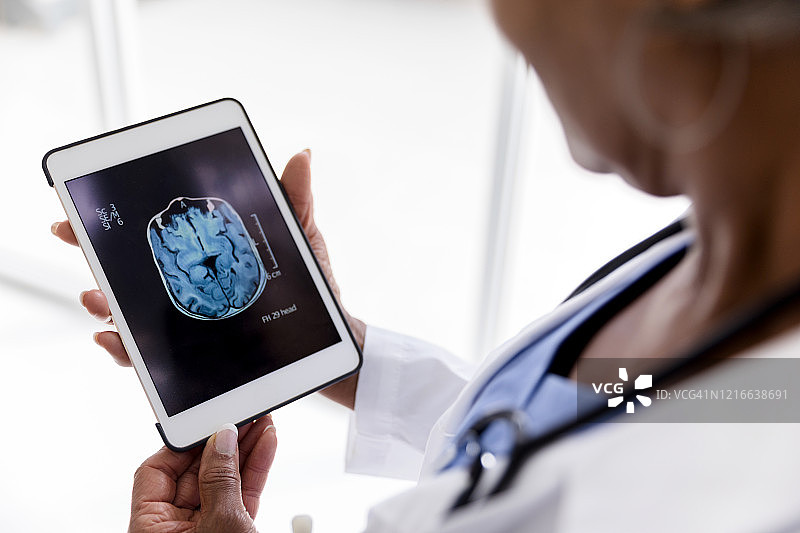 女外科医生手持数码平板电脑，屏幕上显示着脑部x光片图片素材