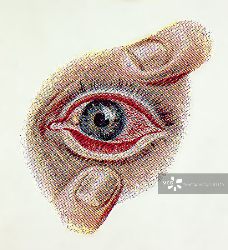 古老的眼睛感染和疾病的雕刻插图图片素材