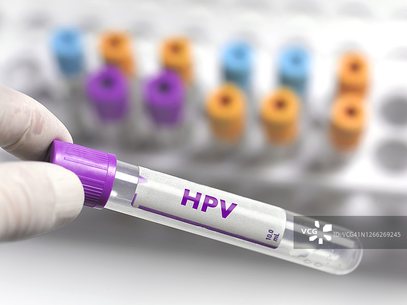 含有HPV疫苗的试管图片素材