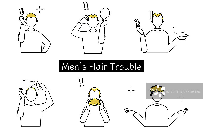 AGA男士头发问题情况说明图片素材
