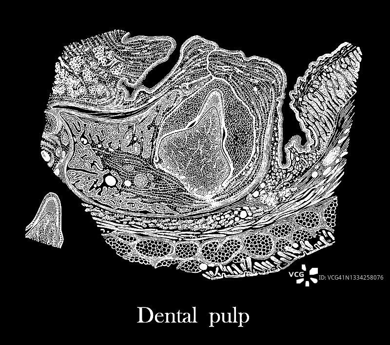 显微镜下看到古老的牙髓雕刻插图图片素材
