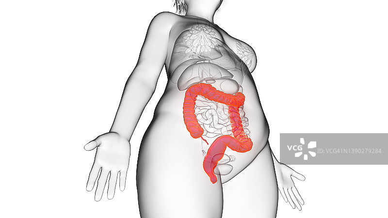 肥胖妇女的结肠，插图图片素材