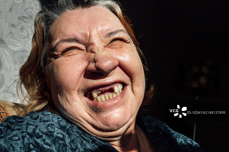 一个成年女性，门牙已经脱落和拔了，满嘴都是蛀牙、蛀牙、黄斑和牙垢图片素材