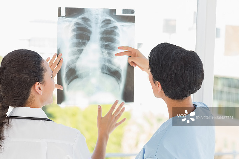两位女医生检查x光片的后视图图片素材