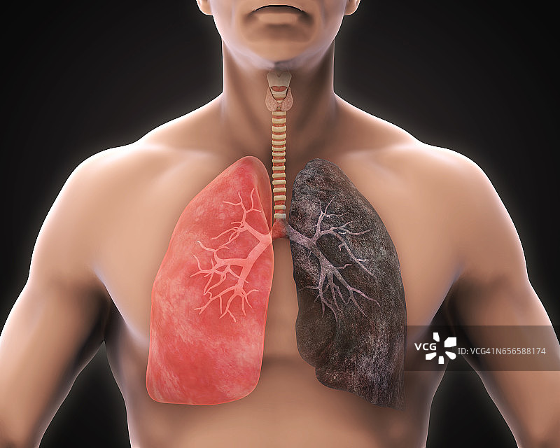 健康的肺和吸烟者的肺图片素材