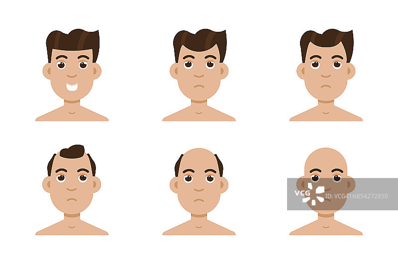 发阶段损失。男性头部秃顶向量的类型。图片素材