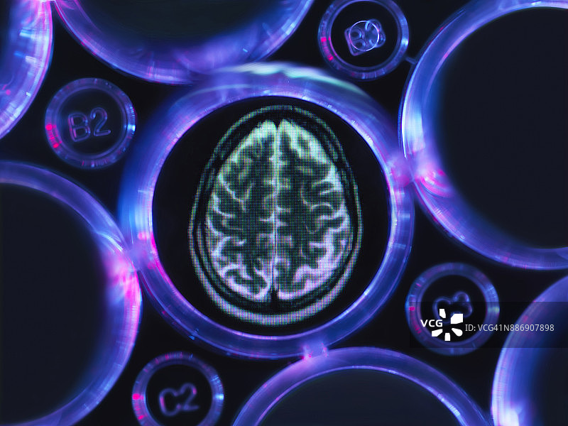 阿尔茨海默症和痴呆症的研究，一个大脑扫描在多孔托盘用于实验室的研究实验图片素材