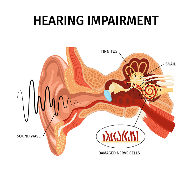听力损伤解剖组成图片下载