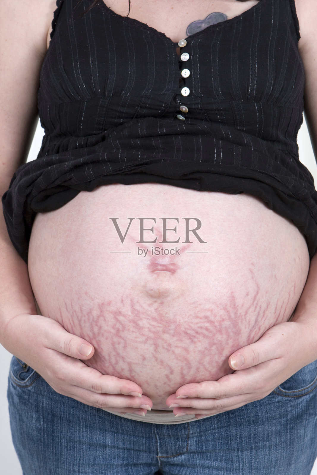 一个孕妇抱着她的肚子和妊娠纹照片摄影图片