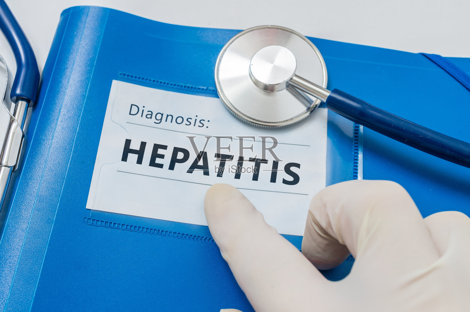 四、慢性病毒性肝炎的多重感染-肝脏诊断病理学-医学