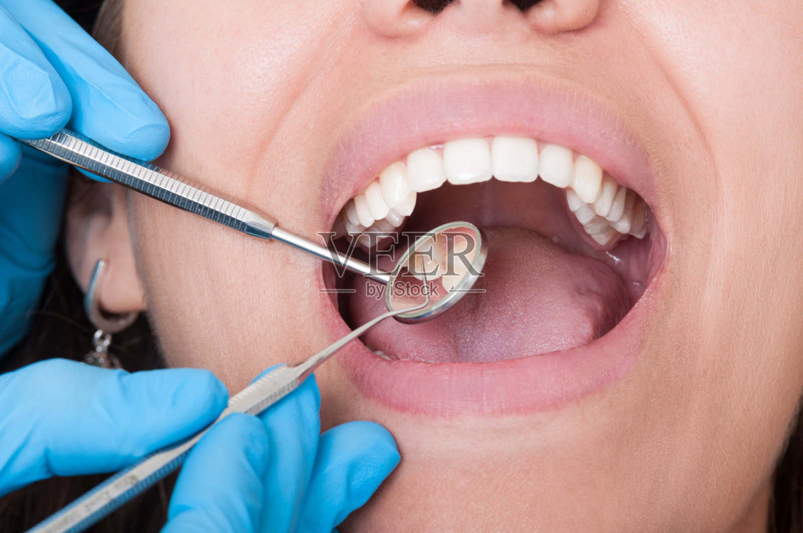 牙医的工具和张开的嘴和美丽的牙齿照片摄影图片