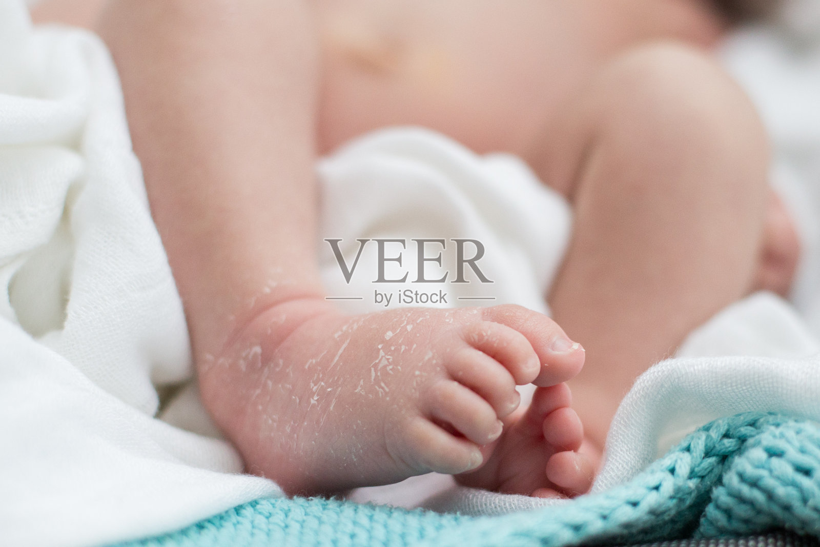 皮肤干燥，新生儿足部白色和蓝色背景照片摄影图片