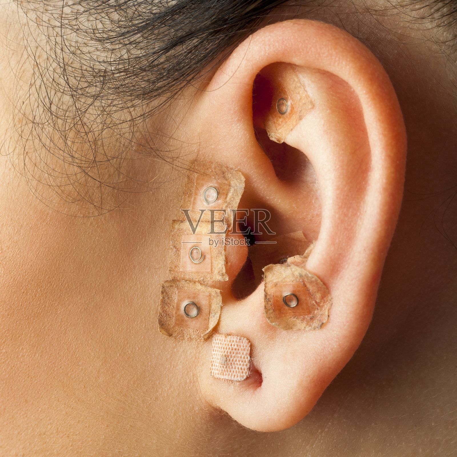 人耳耳疗法。照片摄影图片
