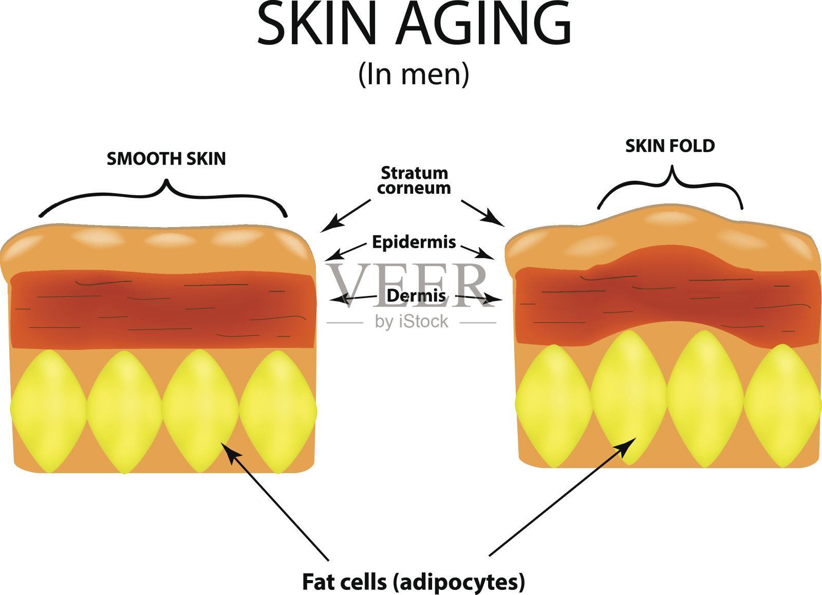 男性皮肤老化。信息图。矢量插图在孤立的背景插画图片素材