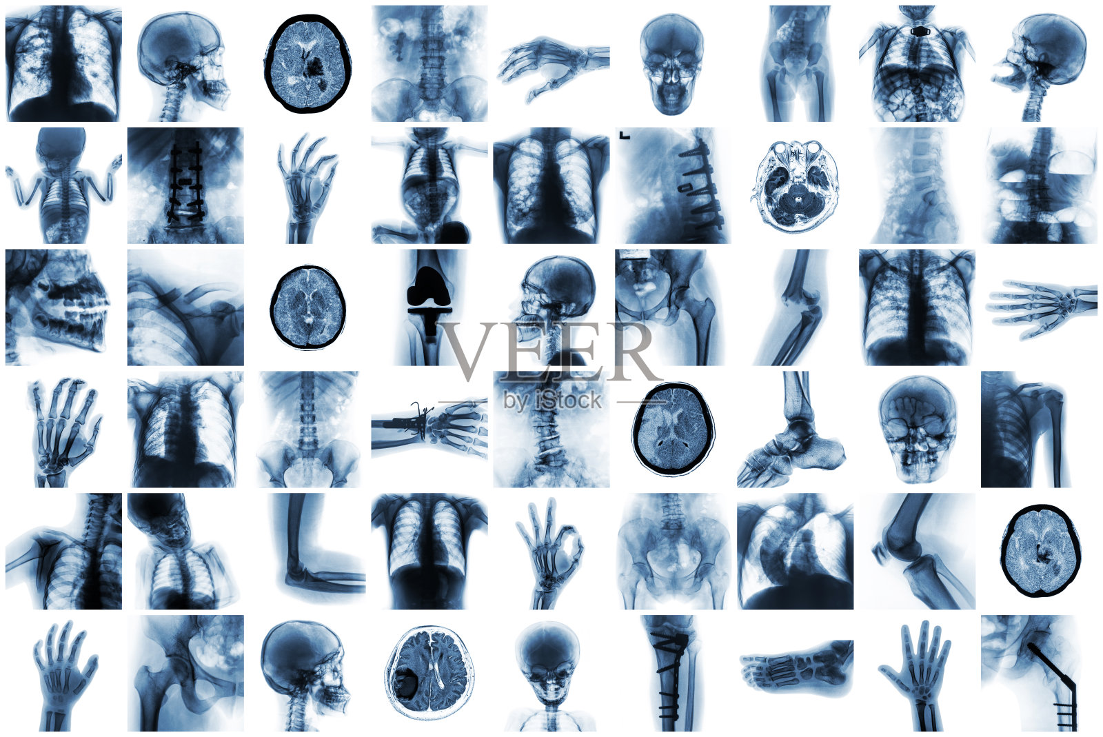 x光对人体的多个部位和许多医疗状况和疾病都有影响照片摄影图片