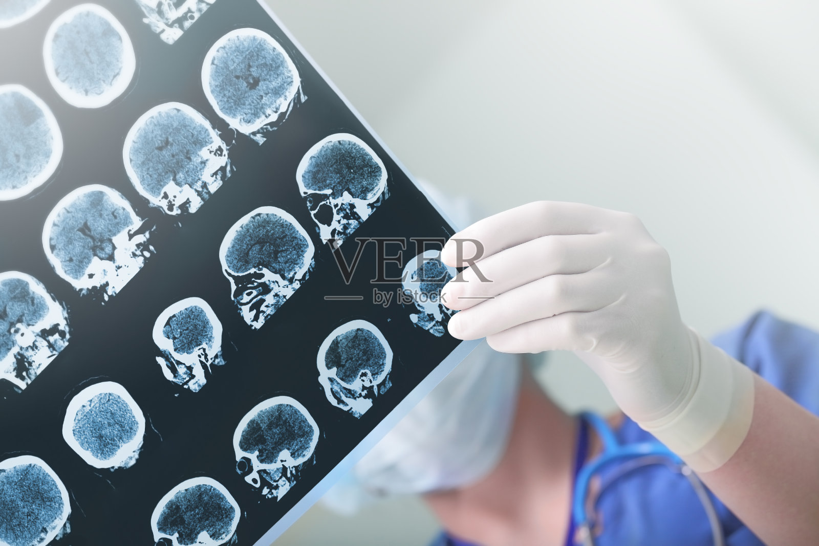 医学专家研究了病人的脑电图情况照片摄影图片