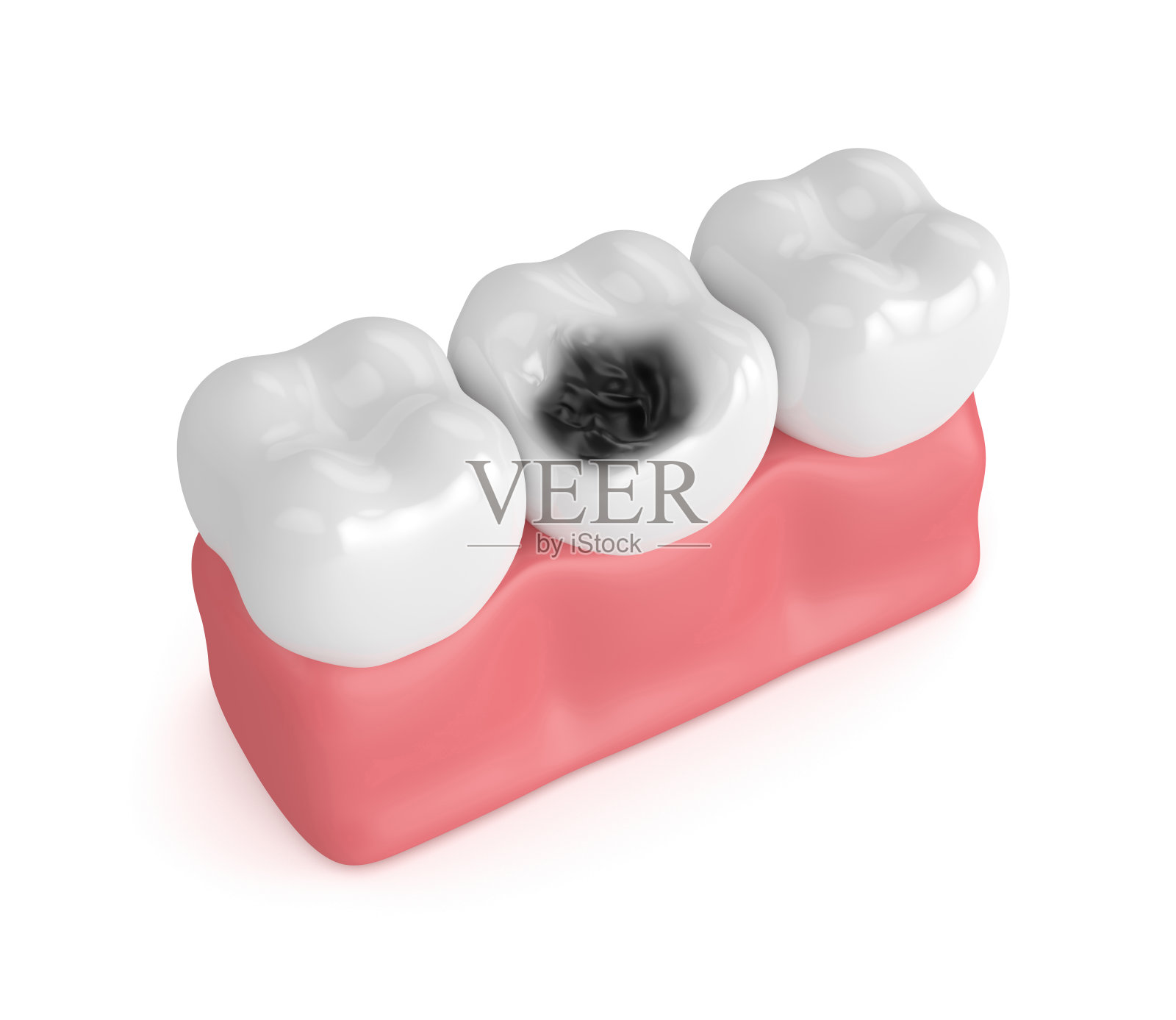 牙齿的3d渲染牙龈与龋齿设计元素图片