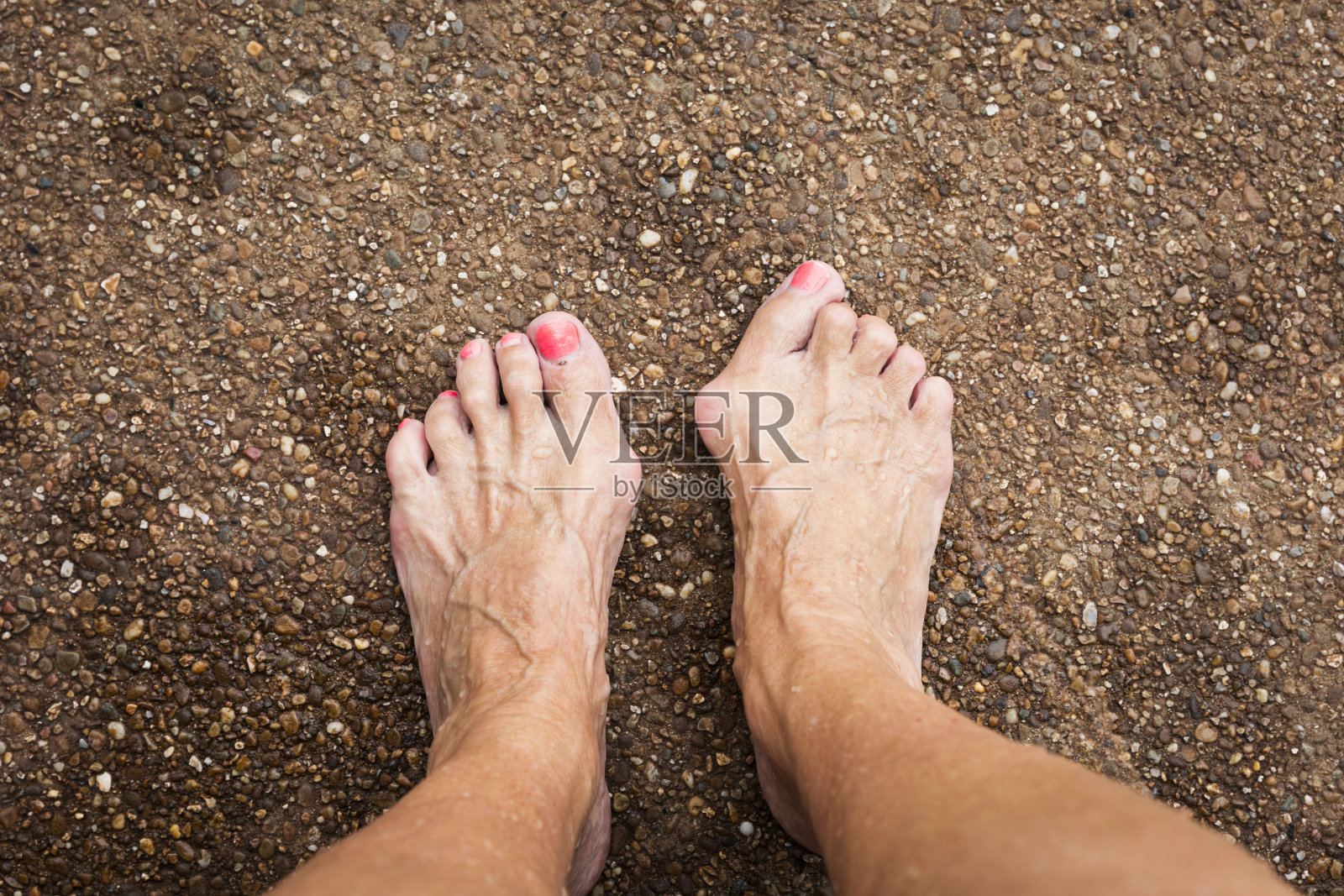 赤裸的脚显示双侧拇囊炎和锤状脚趾年长白人妇女站在户外人行道在一个夏天照片摄影图片