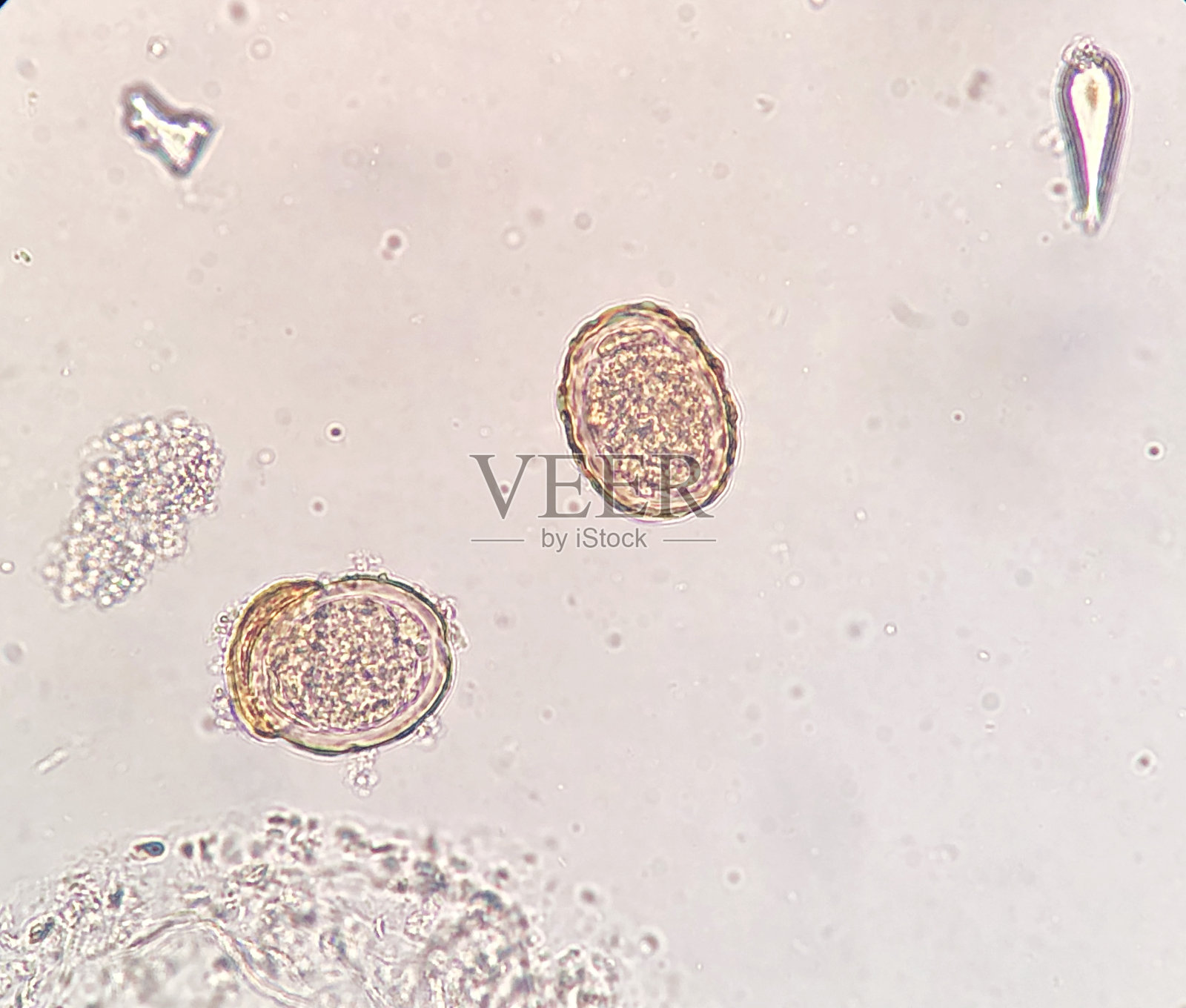 [题][图]常见寄生虫卵显微镜下实拍图（检验职称考试中必考一图）