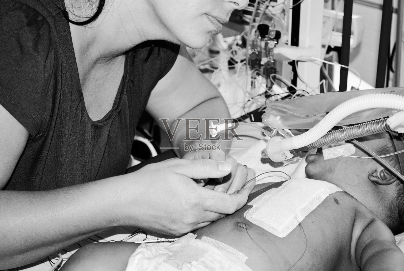 在医院的儿科重症监护病房，一位母亲用手安慰一个挂在呼吸机上的危重婴儿。黑色和白色照片摄影图片