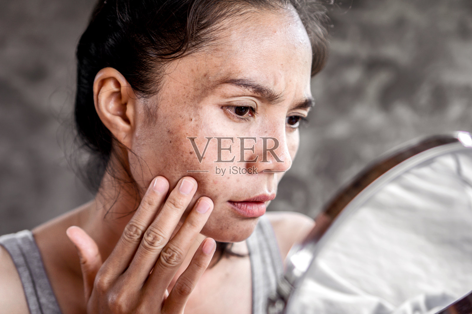 有皮肤问题的亚洲妇女检查她的脸与黑斑，雀斑从紫外线照片摄影图片