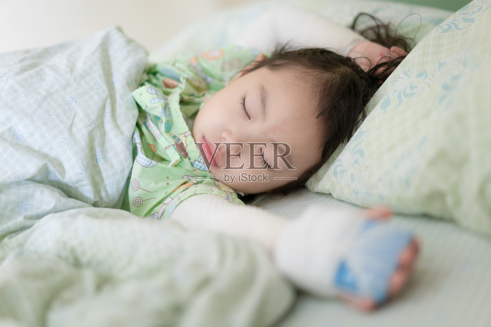 亚洲小女孩躺在医院的病床上，女婴因皮肤过敏，颈部和双臂用绷带包裹，特应性皮炎(AD)照片摄影图片